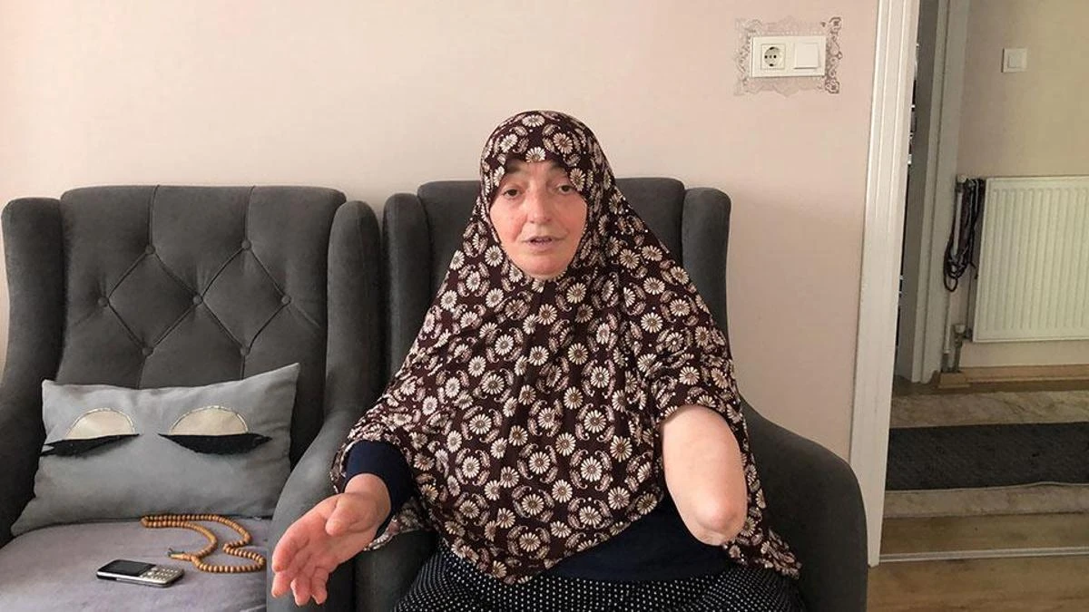 Köpek saldırısında kolu amputasyonla kesilen kadın 6 yıl sonra öldü