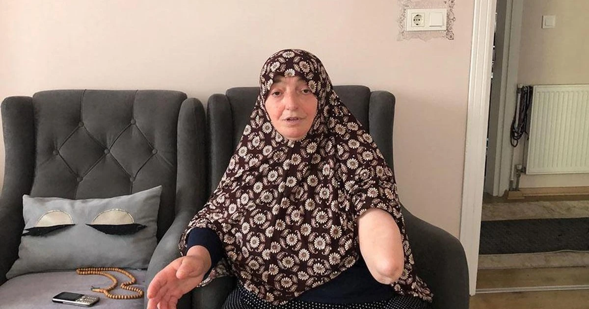 Köpek saldırısında kolu amputasyonla kesilen kadın 6 yıl sonra öldü