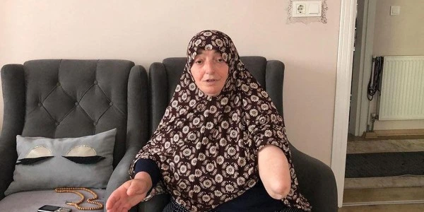 Köpek saldırısında kolu amputasyonla kesilen kadın 6 yıl sonra öldü