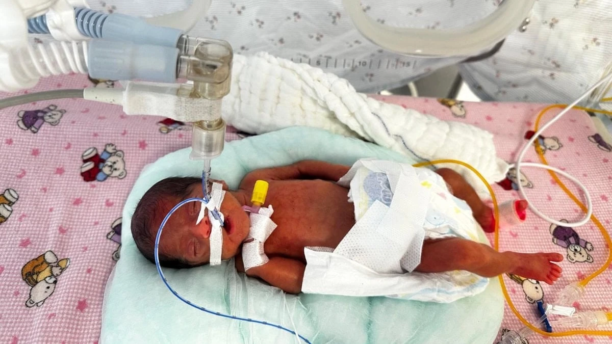 Antalya'da 650 gram doğan Leyla bebek hayata tutundu