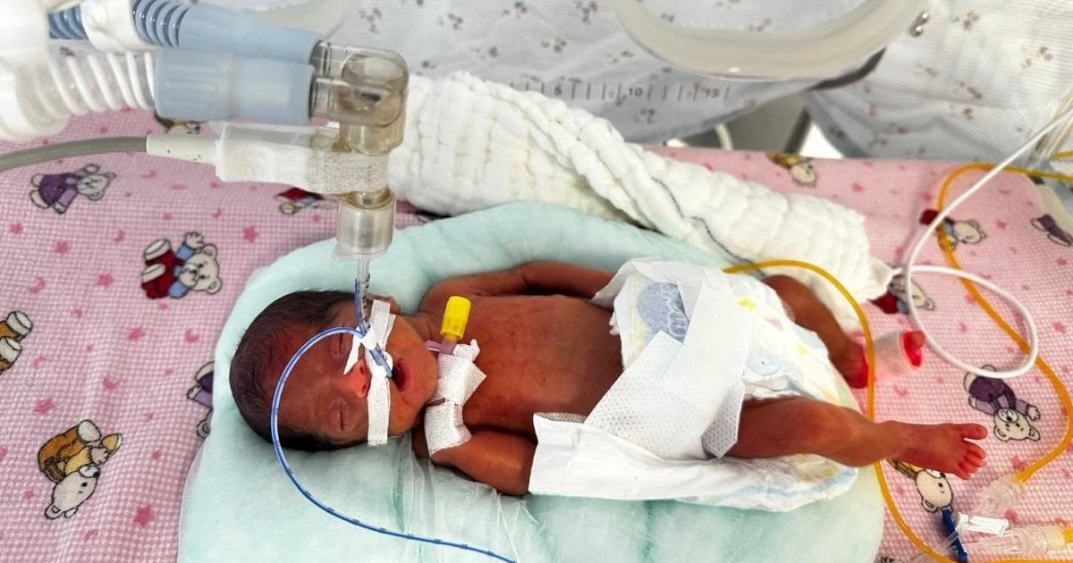 Antalya'da 650 gram doğan Leyla bebek hayata tutundu