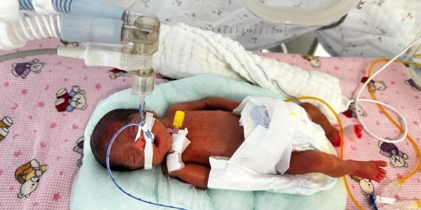 Antalya'da 650 gram doğan Leyla bebek hayata tutundu