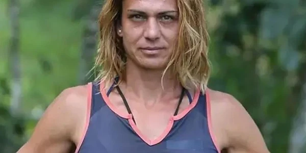 Nagihan Karadere, estetik operasyon sonrası son halini paylaştı