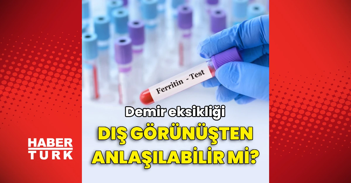 Demir eksikliği dış görünüşten anlaşılabilir mi? Uzman yanıtladı