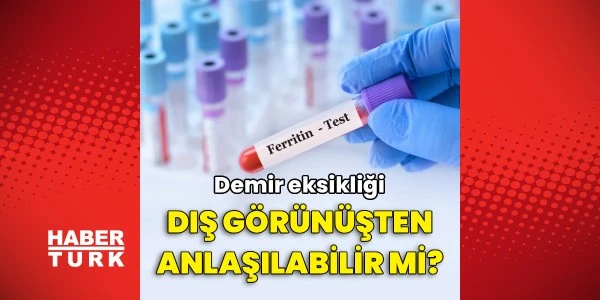 Demir eksikliği dış görünüşten anlaşılabilir mi? Uzman yanıtladı